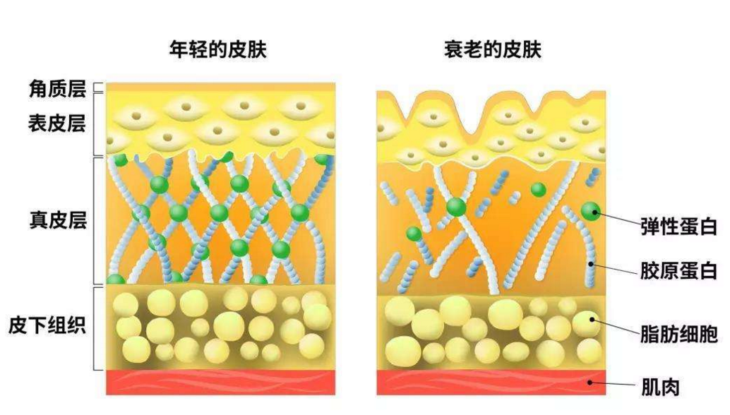 皮肤衰老对比.png